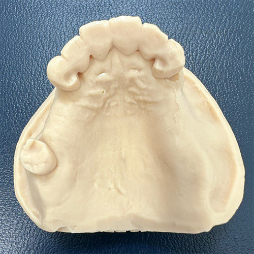 口腔内スキャナーで記録されたデーターを3Dプリンターでアクリル模型に光造形(Stereolithography Apparatus)
